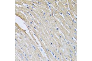 Immunohistochemistry of paraffin-embedded rat heart using CRHBP antibody at dilution of 1:100 (40x lens). (CRHBP antibody)