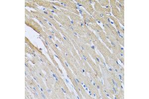 Immunohistochemistry of paraffin-embedded rat heart using CRHBP antibody at dilution of 1:100 (40x lens).
