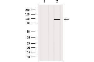 Western blot analysis of extracts from HUVEC, using TAS1R2 Antibody.