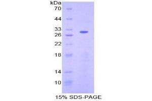 SDS-PAGE analysis of Human ATF6 Protein. (ATF6 Protein)