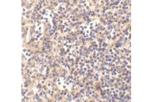 Immunohistochemical staining ofDNaseII in human spleen with DNase II antibody at 5μg/ml. (DNASE2 antibody)