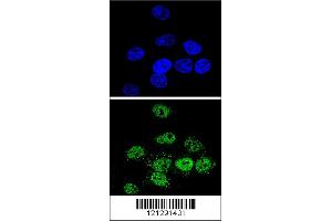 Confocal immunofluorescent analysis of MEF2A Antibody with Hela cell followed by Alexa Fluor 488-conjugated goat anti-rabbit lgG (green). (MEF2A antibody  (AA 453-479))
