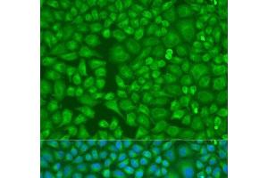 Immunofluorescence analysis of U2OS cells using LLGL2 Polyclonal Antibody at dilution of 1:100. (LLGL2 antibody)