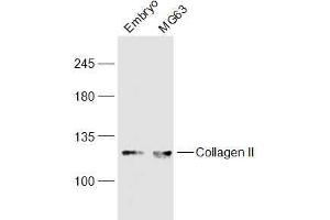 Lane 1: Mouse Embryo lysates Lane 2: MG63 lysates probed with COL2A1 Polyclonal Antibody, Unconjugated  at 1:300 dilution and 4˚C overnight incubation. (COL2A1 antibody  (AA 231-330))