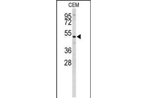 Western blot analysis of CNDP1 Antibody in CEM cell line lysates (35ug/lane) (CNDP1 antibody  (C-Term))