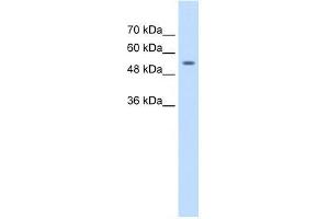 Human Jurkat; WB Suggested Anti-ZNF498 Antibody Titration: 1.