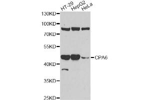 Western blot analysis of extracts of various cell lines, using CPA6 antibody (ABIN6291611) at 1:1000 dilution.