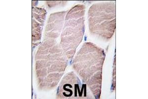 Formalin-fixed and paraffin-embedded human skeletal muscle tissue reacted with PYGM antibody , which was peroxidase-conjugated to the secondary antibody, followed by DAB staining. (PYGM antibody  (C-Term))