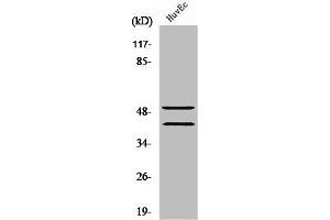Western Blot analysis of Jurkat cells using TCF-1 Polyclonal Antibody (TCF7 antibody  (N-Term))
