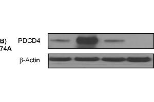 Immunohistochemistry (IHC) image for anti-Programmed Cell Death 4 (PDCD4) (pSer457) antibody (ABIN129708)