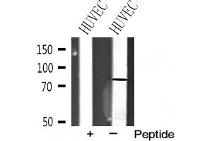 Western blot analysis of FSHR expression in HUVEC cell extracts (FSHR antibody  (Internal Region))