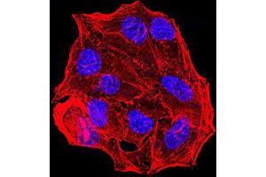 Immunofluorescence analysis of Hela cells using ESR1 mouse mAb. (Estrogen Receptor alpha antibody  (AA 2-185))