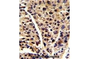 Immunohistochemistry (IHC) image for anti-Enolase 3 (Beta, Muscle) (ENO3) antibody (ABIN3001691) (ENO3 antibody)
