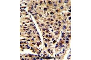Immunohistochemistry (IHC) image for anti-Enolase 3 (Beta, Muscle) (ENO3) antibody (ABIN3001691)