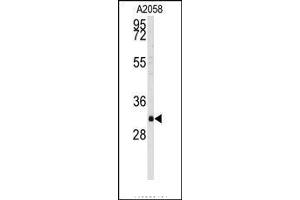 Image no. 1 for anti-WW Domain Binding Protein 2 (WBP2) (C-Term) antibody (ABIN360095) (WBP2 antibody  (C-Term))