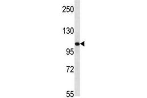 TLR8 antibody western blot analysis in mouse bladder tissue lysate (TLR8 antibody  (AA 957-987))
