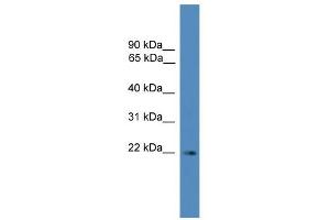 WB Suggested Anti-SSX3 Antibody Titration: 0. (SSX3 antibody  (N-Term))