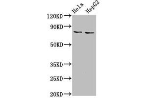 Western Blot Positive WB detected in: Hela whole cell lysate, HepG2 whole cell lysate All lanes: ESRP2 antibody at 6 μg/mL Secondary Goat polyclonal to rabbit IgG at 1/50000 dilution Predicted band size: 79, 78 kDa Observed band size: 79 kDa (ESRP2 antibody  (AA 615-720))