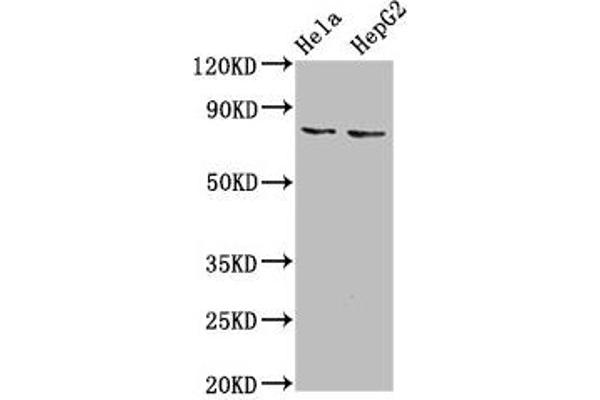 ESRP2 anticorps  (AA 615-720)