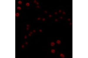 ABIN6266706 staining COLO205 by IF/ICC. (T-Box 1 antibody  (C-Term))