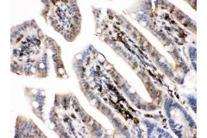 IHC analysis of PKC alpha using anti-PKC alpha antibody (ABIN3043549). (PKC alpha antibody  (AA 153-342))