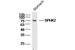 Mouse stomach lysates probed with SPHK2 Polyclonal Antibody, unconjugated  at 1:300 overnight at 4°C followed by a conjugated secondary antibody for 60 minutes at 37°C.