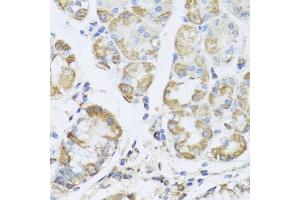 Immunohistochemistry of paraffin-embedded human stomach using PRK antibody (ABIN6132517, ABIN6146187, ABIN6146188 and ABIN6223135) at dilution of 1:100 (40x lens). (PRKAG1 antibody  (AA 1-331))