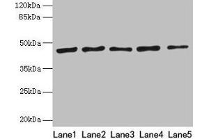 Western blot All lanes: RRM2 antibody at 8 μg/mL Lane 1: HepG2 whole cell lysate Lane 2: Jurkat whole cell lysate Lane 3: Hela whole cell lysate Lane 4: K562 whole cell lysate Lane 5: 293T whole cell lysate Secondary Goat polyclonal to rabbit IgG at 1/10000 dilution Predicted band size: 45, 52 kDa Observed band size: 45 kDa (RRM2 antibody  (AA 1-389))