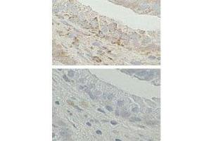 IHC analysis of FFPE human prostate tissue. (Endoplasmic Reticulum Amyloid Binding Protein (ERAB) (AA 199-235) antibody)