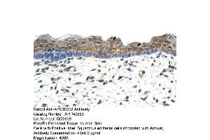 Rabbit Anti-APOBEC2 Antibody  Paraffin Embedded Tissue: Human Skin Cellular Data: Squamous epithelial cells Antibody Concentration: 4. (APOBEC2 antibody  (N-Term))