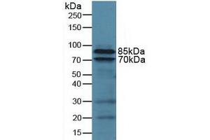 Figure. (Integrin beta 2 antibody  (AA 451-627))