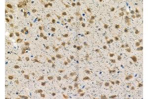 ABIN6257543 and ABIN6274338 at 1/100 staining Rat brain tissue by IHC-P.