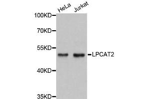Western blot analysis of extracts of various cell lines, using LPCAT2 antibody (ABIN1876112) at 1:3000 dilution. (LPCAT2 antibody)