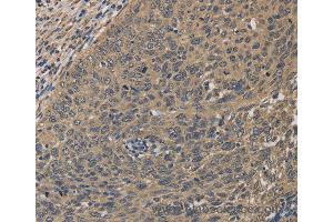 Immunohistochemistry of Human tonsil using HSF1 Polyclonal Antibody at dilution of 1:60 (HSF1 antibody)