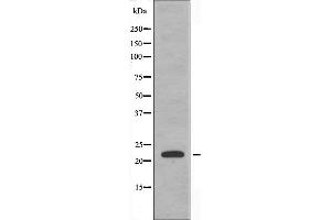 Western blot analysis of extracts from HeLa cells using CBF β antibody. (CBFB antibody  (N-Term))