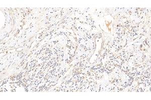 Immunohistochemistry (IHC) image for anti-Dipeptidyl-Peptidase 3 (DPP3) (AA 2-261) antibody (ABIN7445195)