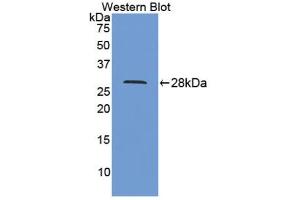Figure. (IL9 Receptor antibody  (AA 47-257))