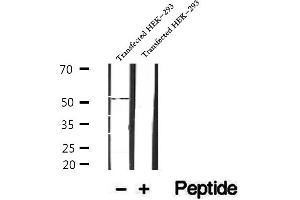 Western blot analysis of extracts of human placenta tissue, using SRPX2 antibody. (SRPX2 antibody  (Internal Region))