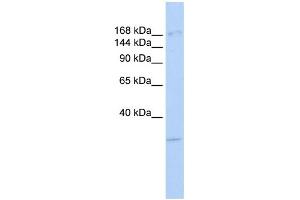 WB Suggested Anti-UTX Antibody Titration: 0. (KDM6A antibody  (Middle Region))