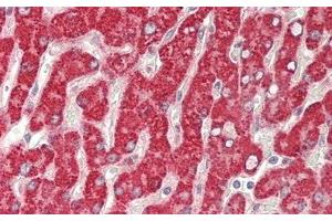 Detection of GBA in Human Liver Tissue using Polyclonal Antibody to Glucocerebrosidase (GBA) (GBA antibody  (AA 117-214))