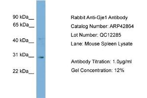 WB Suggested Anti-Gje1 Antibody Titration:  0. (GJE1 antibody  (N-Term))