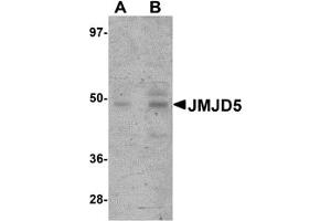 Western Blotting (WB) image for anti-Jumonji Domain Containing 5 (JMJD5) (C-Term) antibody (ABIN1030455)
