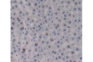 IHC-P analysis of Kidney tissue, with DAB staining. (PTPRJ antibody  (AA 1033-1277))
