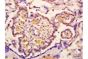 Formalin-fixed and paraffin embedded mouse placenta labeled with Anti-Phospho-IRAK1(Thr209) Polyclonal Antibody, Unconjugated (ABIN1385694) at 1:200 followed by conjugation to the secondary antibody and DAB staining (IRAK1 antibody  (pThr209))