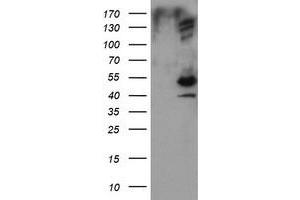 Image no. 1 for anti-DIX Domain Containing 1 (DIXDC1) antibody (ABIN1497840) (DIXDC1 antibody)