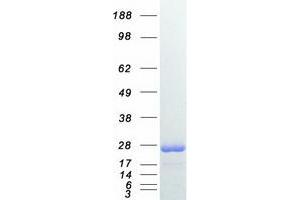Western Blotting (WB) image for RAB7A, Member RAS Oncogene Family (RAB7A) protein (Myc-DYKDDDDK Tag) (ABIN2730367)