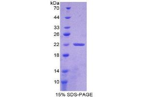 SDS-PAGE (SDS) image for Chloride Intracellular Channel 1 (CLIC1) (AA 79-241) protein (His tag) (ABIN2124322) (CLIC1 Protein (AA 79-241) (His tag))