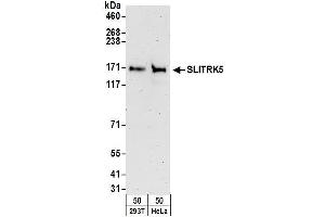 Western Blotting (WB) image for anti-SLIT and NTRK-Like Family, Member 5 (SLITRK5) (AA 875-925) antibody (ABIN7452973)
