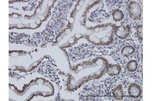 Immunostaining (ISt) image for anti-Histone Deacetylase 1 (HDAC1) (AA 1-482) antibody (ABIN561246)