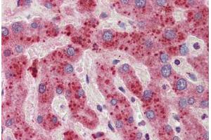 Human Liver: Formalin-Fixed, Paraffin-Embedded (FFPE) (14-3-3 zeta antibody  (C-Term))